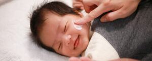 kulit bayi mengelupas
