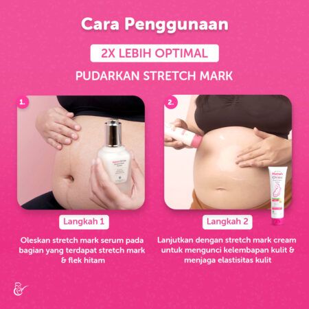 Cara Penggunaan Produk Stretch Mark Serum dan Cream